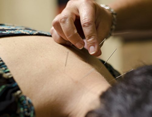 The Top Benefits of Mesa Acupuncture Treatments