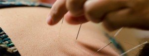 Mesa Acupuncture at Bodyworkz