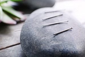Chandler AZ Acupuncture Treatments by The Experts at Bodyworkz