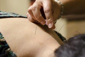 Mesa Acupuncture Treatments