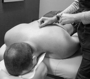 Professional acupuncture treatments available in Mesa 85205