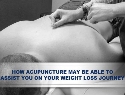 How acupuncture may be able to assist you on your weight loss journey