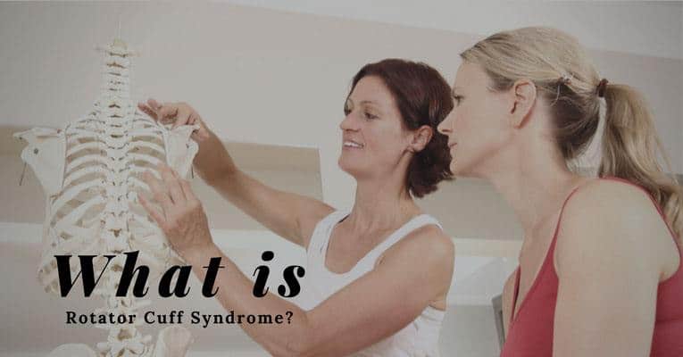 what is rotator cuff syndrome