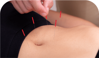 Top-Rated Acupuncture Services